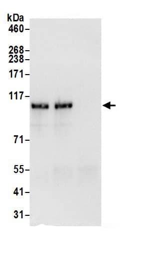 Immunoprecipitation:HIP1 AntibodyNBP3-30624] -Detection of human HIP1 by western blot of immunoprecipitates. Samples: Whole cell lysate (0.5 or 1.0 mg per IP reaction; 20% of IP loaded) from HeLa cells prepared using NETN lysis buffer. Antibodies: Affinity purified rabbit anti-HIP1 antibody NBP3-30624 (lot NBP3-30624-1) used for IP at 6 µg per reaction. HIP1 was also immunoprecipitated by rabbit anti-HIP1.. For blotting immunoprecipitated HIP1, NBP3-30624 was used at 0.4 µg/ml. Detection: Chemiluminescence with an exposure time of 3 seconds.