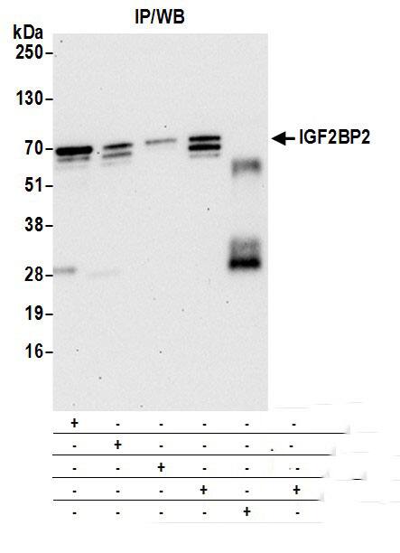 Immunoprecipitation:[NBP3-30626]-Detection of human IGF2BP2 by western blot of immunoprecipitates. Samples: Whole cell lysate from 293T cells prepared using NETN lysis buffer. Antibodies: Mouse monoclonal anti-IGF2BP2 antibody [3A3. 5F1] used for IP at 20 µl per reaction. IGF2BP2 was also immunoprecipitated by mouse monoclonal anti-IGF2BP2 antibody and rabbit anti-IGF2BP2 antibodies. For blotting immunoprecipitated IGF2BP2, was used at 1: 1000. Secondary: HRP-conjugated goat anti-mouse IgG. Detection: Chemiluminescence with an exposure time of 30 seconds.