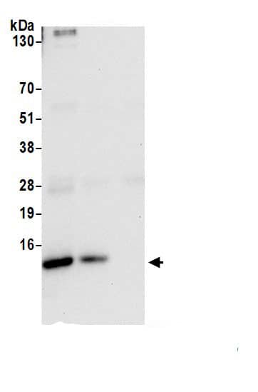 Immunoprecipitation:UQCRQ AntibodyNBP3-30630] -Detection of human UQCRQ by western blot of immunoprecipitates. Samples: Whole cell lysate (1.0 mg per IP reaction; 20% of IP loaded) from 293T cells prepared using NETN lysis buffer. Antibodies: Affinity purified rabbit anti-UQCRQ antibody (NBP3-30630 lot 1) used for IP at 2 µg per reaction. UQCRQ was also immunoprecipitated by rabbit anti-UQCRQ.. For blotting immunoprecipitated UQCRQ, NBP3-30630 was used at 0.1 mg/ml. Detection: Chemiluminescence with an exposure time of 10 seconds.