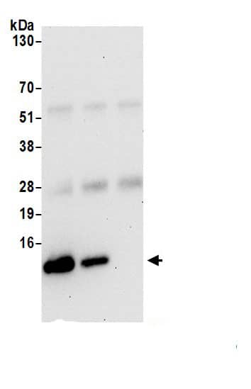 Immunoprecipitation:UQCRQ AntibodyNBP3-30631] -Detection of human UQCRQ by western blot of immunoprecipitates. Samples: Whole cell lysate (1.0 mg per IP reaction; 20% of IP loaded) from 293T cells prepared using NETN lysis buffer. Antibodies: Affinity purified rabbit anti-UQCRQ antibody (NBP3-30631 lot 1) used for IP at 2 µg per reaction. UQCRQ was also immunoprecipitated by rabbit anti-UQCRQ.. For blotting immunoprecipitated UQCRQ, NBP3-30631 was used at 0.1 mg/ml. Detection: Chemiluminescence with an exposure time of 30 seconds.