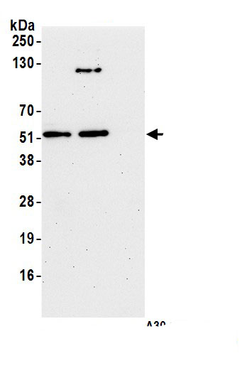 Immunoprecipitation:UFM1 Activating Enzyme/UBA5 AntibodyNBP3-30632] -Detection of human UBA5 by western blot of immunoprecipitates. Samples: Whole cell lysate (1.0 mg per IP reaction; 20% of IP loaded) from HEK293T cells prepared using NETN lysis buffer. Antibodies: Affinity purified rabbit anti-UBA5 antibody NBP3-30632 (lot NBP3-30632-2) used for IP at 6 µg per reaction. UBA5 was also immunoprecipitated by a previous lot of this antibody (lot NBP3-30632-1). For blotting immunoprecipitated UBA5, NBP3-30632 was used at 0.1 µg/ml. Detection: Chemiluminescence with an exposure time of 30 seconds.