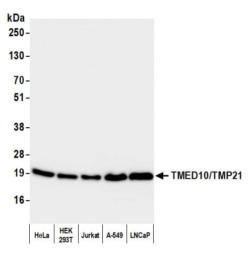 Western Blot:[NBP3-30633]-Detection of human TMED10/TMP21 by western blot. Samples: Whole cell lysate from HeLa, HEK293T, Jurkat, A-549, and LNCaP cells prepared using NETN lysis buffer. Antibody: Affinity purified rabbit anti-TMED10/TMP21 antibody used for WB at 0. 1 µg/ml. Detection: Chemiluminescence with an exposure time of 10 seconds.