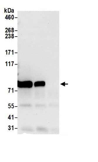 Immunoprecipitation:TARS AntibodyNBP3-30636] -Detection of human TARS by western blot of immunoprecipitates. Samples: Whole cell lysate (0.5 or 1.0 mg per IP reaction; 20% of IP loaded) from 293T cells prepared using NETN lysis buffer. Antibodies: Affinity purified rabbit anti-TARS antibody NBP3-30636 (lot NBP3-30636-1) used for IP at 6 µg per reaction. TARS was also immunoprecipitated by rabbit anti-TARS.. For blotting immunoprecipitated TARS, NBP3-30636 was used at 0.4 µg/ml. Detection: Chemiluminescence with an exposure time of 10 seconds.