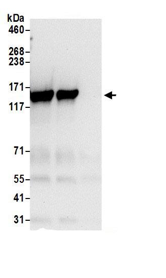 Immunoprecipitation:Tripeptidyl peptidase II AntibodyNBP3-30637] -Detection of human TPP2 by western blot of immunoprecipitates. Samples: Whole cell lysate (0.5 or 1.0 mg per IP reaction; 20% of IP loaded) from 293T cells prepared using NETN lysis buffer. Antibodies: Affinity purified rabbit anti-TPP2 antibody NBP3-30637 (lot NBP3-30637-1) used for IP at 6 µg per reaction. TPP2 was also immunoprecipitated by rabbit anti-TPP2.. For blotting immunoprecipitated TPP2, NBP3-30637 was used at 0.4 µg/ml. Detection: Chemiluminescence with an exposure time of 10 seconds.