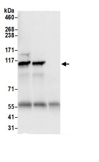 Immunoprecipitation:SEC24C AntibodyNBP3-30638] -Detection of human SEC24C by western blot of immunoprecipitates. Samples: Whole cell lysate (0.5 or 1.0 mg per IP reaction; 20% of IP loaded) from 293T cells prepared using NETN lysis buffer. Antibodies: Affinity purified rabbit anti-SEC24C antibody NBP3-30638 (lot NBP3-30638-1) used for IP at 6 µg per reaction. SEC24C was also immunoprecipitated by rabbit anti-SEC24C.. For blotting immunoprecipitated SEC24C, NBP3-30638 was used at 0.4 µg/ml. Detection: Chemiluminescence with an exposure time of 1 second.