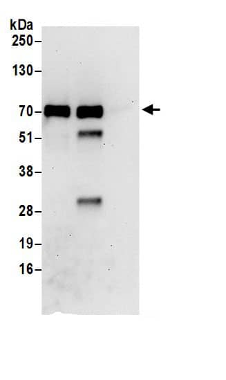 Immunoprecipitation:CTP synthase AntibodyNBP3-30639] -Detection of human CTPS1 by western blot of immunoprecipitates. Samples: Whole cell lysate (0.5 or 1.0 mg per IP reaction; 20% of IP loaded) from 293T cells prepared using NETN lysis buffer. Antibodies: Affinity purified rabbit anti-CTPS1 antibody NBP3-30639 (lot NBP3-30639-1) used for IP at 6 µg per reaction. CTPS1 was also immunoprecipitated by rabbit anti-CTPS1 antibody for blotting immunoprecipitated CTPS1, NBP3-30639 was used at 1 µg/ml. Detection: Chemiluminescence with an exposure time of 30 seconds.
