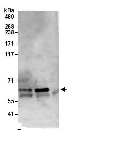 Immunoprecipitation:GLMN AntibodyNBP3-30640] -Detection of human GLMN/Glomulin by western blot of immunoprecipitates. Samples: Whole cell lysate (0.5 or 1.0 mg per IP reaction; 20% of IP loaded) from 293T cells prepared using NETN lysis buffer. Antibodies: Affinity purified rabbit anti-GLMN/Glomulin antibody NBP3-30640 (lot NBP3-30640-1) used for IP at 6 µg per reaction. GLMN/Glomulin was also immunoprecipitated by rabbit anti-GLMN/Glomulin antibody BL19693. For blotting immunoprecipitated GLMN/Glomulin, NBP3-30640 was used at 1 µg/ml. Detection: Chemiluminescence with an exposure time of 30 seconds.