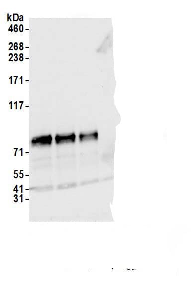 Immunoprecipitation:BRD9 AntibodyNBP3-30641] -Detection of human BRD9 by western blot of immunoprecipitates. Samples: Whole cell lysate (1.0 mg per IP reaction; 10% of IP loaded) from Jurkat cells prepared using NETN lysis buffer. Antibodies: Affinity purified rabbit anti-BRD9 antibody (NBP3-30641 lot 3) used for IP at 6 µg per reaction. BRD9 was also immunoprecipitated by a previous lot of this antibody (NBP3-30641 lot 2) and another.inst a different epitope of BRD9 (BL13599). For blotting immunoprecipitated BRD9, NBP3-30641 was used at 0.1 µg/ml. Detection: Chemiluminescence with an exposure time of 3 seconds.