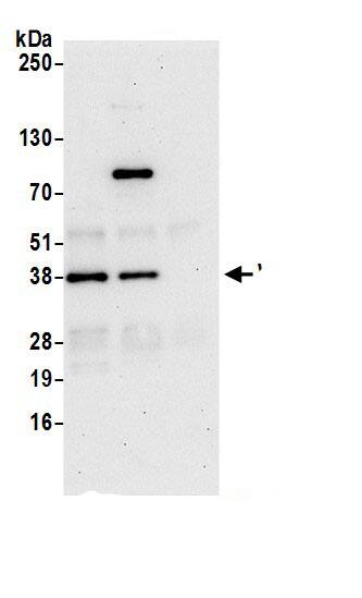 Immunoprecipitation WIPF1/WIP Antibody