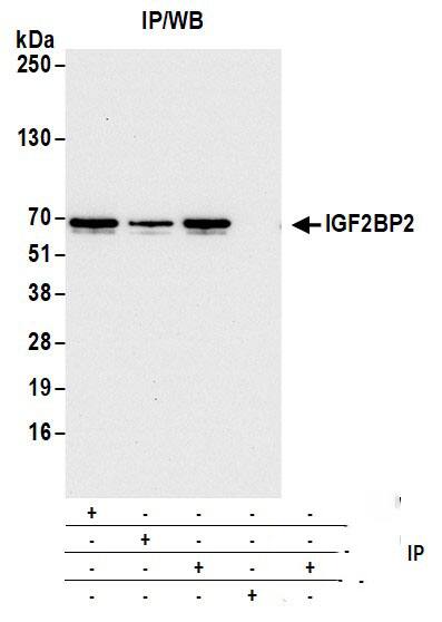 Immunoprecipitation:[NBP3-30645]-Detection of human IGF2BP2 by western blot of immunoprecipitates. Samples: Whole cell lysate from Hep-G2 cells prepared using NETN lysis buffer. Antibodies: Mouse anti-IGF2BP2 monoclonal antibody [1E3. 01E5] used for IP at 8 µl per reaction. IGF2BP2 was also immunoprecipitated by a previous lot of this antibody and mouse anti-IGF2BP2 antibody. For blotting immunoprecipitated IGF2BP2, was used at 1: 1000. Detection: Chemiluminescence with an exposure time of 10 seconds.