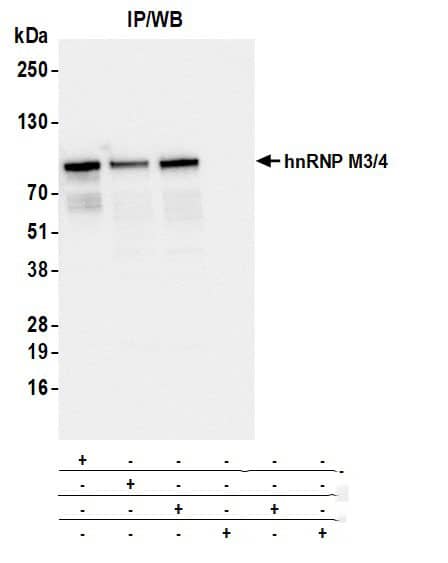 Immunoprecipitation:[NBP3-30646]-Detection of human hnRNP M3/4 by western blot of immunoprecipitates. Samples: Whole cell lysate from HEK293T cells prepared using NETN lysis buffer. Antibodies: Mouse anti-hnRNP M3/4 monoclonal antibody [2A6-2H3] used for IP at 20 µl/mg lysate. hnRNP M3/4 was also immunoprecipitated by a previous lot of this antibody and a second antibody against a different epitope of hnRNP M3/4. For blotting immunoprecipitated hnRNP M3/4, was used at 1: 1000. Detection: Chemiluminescence with an exposure time of 1 second.