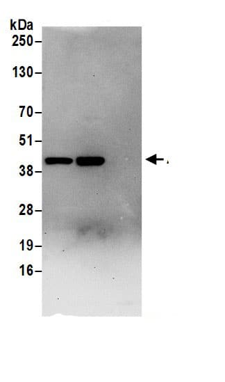 Immunoprecipitation:Aldolase A AntibodyNBP3-30648] -Detection of human ALDOA by western blot of immunoprecipitates. Samples: Whole cell lysate (0.5 or 1.0 mg per IP reaction; 20% of IP loaded) from 293T cells prepared using NETN lysis buffer. Antibodies: Affinity purified rabbit anti-ALDOA antibody NBP3-30648 (lot NBP3-30648-1) used for IP at 6 µg per reaction. ALDOA was also immunoprecipitated by rabbit anti-ALDOA antibody. For blotting immunoprecipitated ALDOA, NBP3-30648 was used at 1 µg/ml. Detection: Chemiluminescence with an exposure time of 30 seconds.