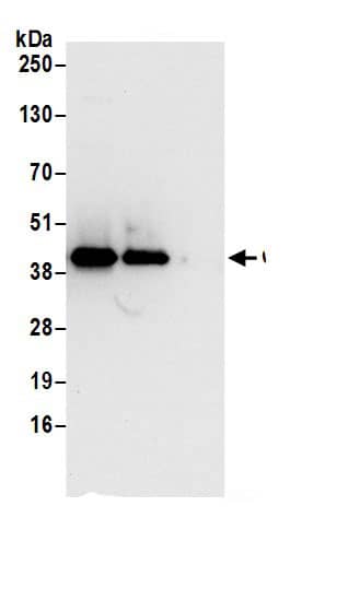 Immunoprecipitation:XAB1 AntibodyNBP3-30649] -Detection of human GPN1 by western blot of immunoprecipitates. Samples: Whole cell lysate (0.5 or 1.0 mg per IP reaction; 20% of IP loaded) from 293T cells prepared using NETN lysis buffer. Antibodies: Affinity purified rabbit anti-GPN1 antibody NBP3-30649 (lot NBP3-30649-1) used for IP at 6 µg per reaction. GPN1 was also immunoprecipitated by rabbit anti-GPN1.. For blotting immunoprecipitated GPN1, NBP3-30649 was used at 0.4 µg/ml. Detection: Chemiluminescence with an exposure time of 10 seconds.