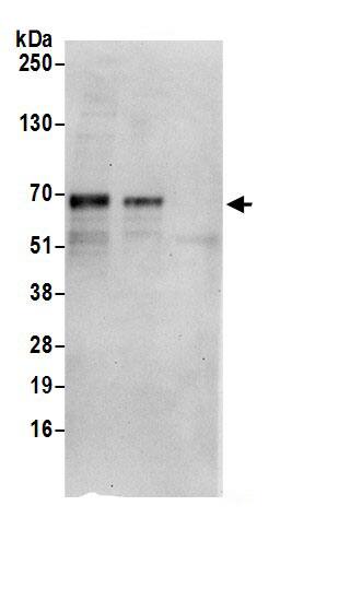 Immunoprecipitation:PPIL4 AntibodyNBP3-30650] -Detection of human PPIL4 by western blot of immunoprecipitates. Samples: Whole cell lysate (0.5 or 1.0 mg per IP reaction; 20% of IP loaded) from HeLa cells prepared using NETN lysis buffer. Antibodies: Affinity purified rabbit anti-PPIL4 antibody NBP3-30650 (lot NBP3-30650-1) used for IP at 6 µg per reaction. PPIL4 was also immunoprecipitated by rabbit anti-PPIL4.. For blotting immunoprecipitated PPIL4, NBP3-30650 was used at 0.4 µg/ml. Detection: Chemiluminescence with an exposure time of 30 seconds.