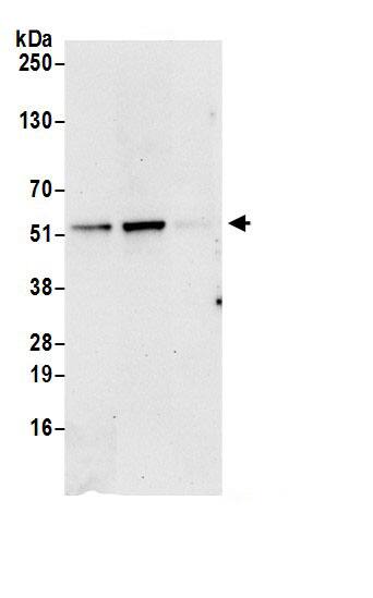 Immunoprecipitation:Proteasome 26S S5 AntibodyNBP3-30651] -Detection of human PSMD5 by western blot of immunoprecipitates. Samples: Whole cell lysate (0.5 or 1.0 mg per IP reaction; 20% of IP loaded) from 293T cells prepared using NETN lysis buffer. Antibodies: Affinity purified rabbit anti-PSMD5 antibody NBP3-30651 (lot NBP3-30651-1) used for IP at 6 µg per reaction. PSMD5 was also immunoprecipitated by rabbit anti-PSMD5 antibody BL19749. For blotting immunoprecipitated PSMD5, NBP3-30651 was used at 1 µg/ml. Detection: Chemiluminescence with an exposure time of 30 seconds.