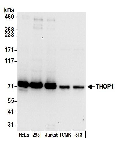 Western Blot:[NBP3-30654]-Detection of human and mouse THOP1 by western blot. Samples: Whole cell lysate from HeLa, HEK293T, Jurkat, mouse TCMK-1, and mouse NIH 3T3 cells prepared using NETN lysis buffer. Antibody: Affinity purified rabbit anti-THOP1 antibody used for WB at 0. 04 µg/ml. Detection: Chemiluminescence with an exposure time of 10 seconds.