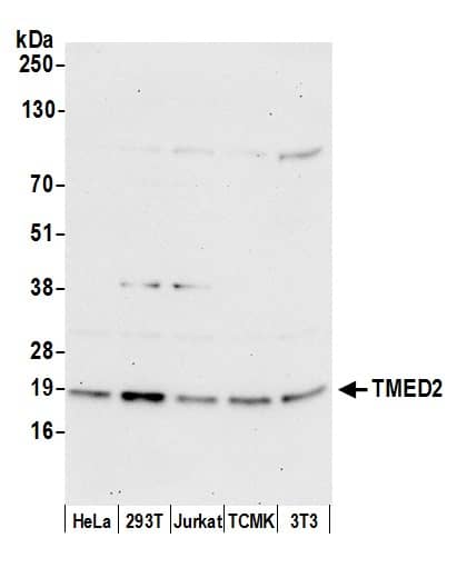 Western Blot:[NBP3-30655]-Detection of human and mouse TMED2 by western blot. Samples: Whole cell lysate from HeLa, HEK293T, Jurkat, mouse TCMK-1, and mouse NIH 3T3 cells prepared using NETN lysis buffer. Antibody: Affinity purified rabbit anti-TMED2 antibody used for WB at 0. 1 µg/ml. Detection: Chemiluminescence with an exposure time of 30 seconds.