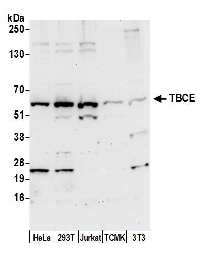 Western Blot:[NBP3-30656]-Detection of human and mouse TBCE by western blot. Samples: Whole cell lysate from HeLa, HEK293T, Jurkat, mouse TCMK-1, and mouse NIH 3T3 cells prepared using NETN lysis buffer. Antibody: Affinity purified rabbit anti-TBCE antibody used for WB at 0. 4 µg/ml. Detection: Chemiluminescence with an exposure time of 30 seconds.