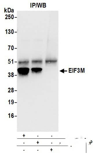 Immunoprecipitation:[NBP3-30663]-Detection of human EIF3M by western blot of immunoprecipitates. Samples: Whole cell lysate from 293T cells prepared using NETN lysis buffer. Antibodies: Affinity purified rabbit anti-EIF3M antibody used for IP at 6 µg per reaction. EIF3M was also immunoprecipitated by rabbit anti-EIF3M antibody. For blotting immunoprecipitated EIF3M, was used at 0. 4 µg/ml. Detection: Chemiluminescence with an exposure time of 1 second.