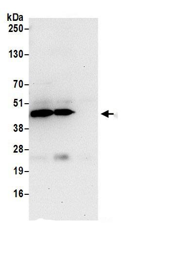 Immunoprecipitation:PPME1 AntibodyNBP3-30664] -Detection of human PPME1/PME-1 by western blot of immunoprecipitates. Samples: Whole cell lysate (0.5 or 1.0 mg per IP reaction; 20% of IP loaded) from Jurkat cells prepared using NETN lysis buffer. Antibody: Affinity purified rabbit anti-PPME1/PME-1 antibody NBP3-30664 (lot NBP3-30664-1) used for IP at 6 µg per reaction. PPME1/PME-1 was also immunoprecipitated by rabbit anti-PPME1/PME-1 antibody BL18030. For blotting immunoprecipitated PPME1/PME-1, NBP3-30664 was used at 1 µg/ml. Detection: Chemiluminescence with an exposure time of 30 seconds.