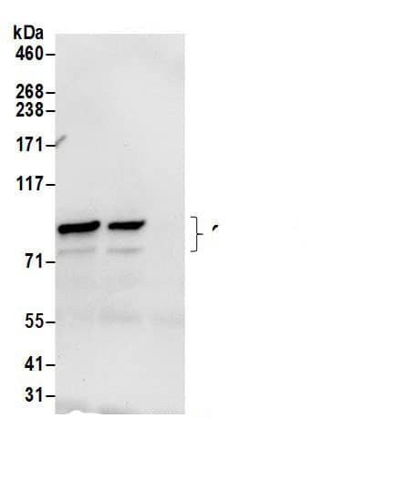 Immunoprecipitation:Gamma Adaptin AntibodyNBP3-30665] -Detection of human gamma Adaptin/AP1G1 by western blot of immunoprecipitates. Samples: Whole cell lysate (0.5 or 1.0 mg per IP reaction; 20% of IP loaded) from HeLa cells prepared using NETN lysis buffer. Antibodies: Affinity purified rabbit anti-gamma Adaptin/AP1G1 antibody NBP3-30665 (lot NBP3-30665-1) used for IP at 6 µg per reaction. gamma Adaptin/AP1G1 was also immunoprecipitated by rabbit anti-gamma Adaptin/AP1G1 antibody. For blotting immunoprecipitated gamma Adaptin/AP1G1, NBP3-30665 was used at 0.4 µg/ml. Detection: Chemiluminescence with an exposure time of 10 seconds.