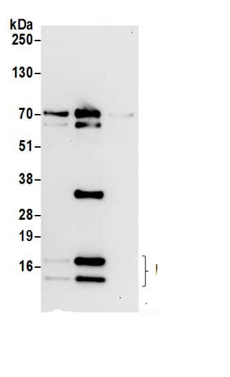 Immunoprecipitation:RPL36 AntibodyNBP3-30666] -Detection of human RPL36 by western blot of immunoprecipitates. Samples: Whole cell lysate (0.5 or 1.0 mg per IP reaction; 20% of IP loaded) from 293T cells prepared using NETN lysis buffer. Antibodies: Affinity purified rabbit anti-RPL36 antibody NBP3-30666 (lot NBP3-30666-1) used for IP at 6 µg per reaction. RPL36 was also immunoprecipitated by rabbit anti-RPL36 antibody BL19950. For blotting immunoprecipitated RPL36, NBP3-30666 was used at 1 µg/ml. Detection: Chemiluminescence with an exposure time of 10 seconds.