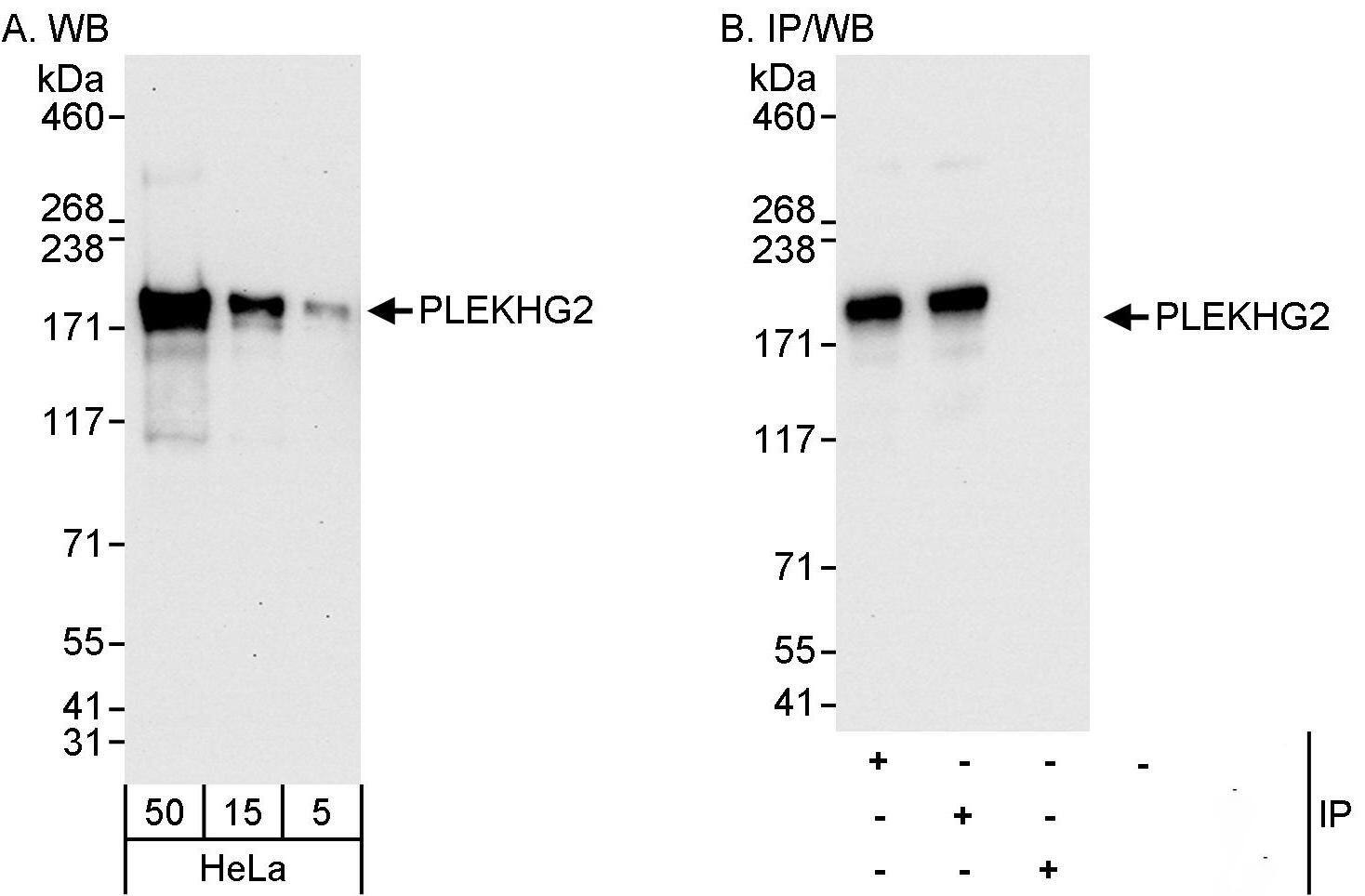 Western Blot:[NBP3-30667]-Detection of human PLEKHG2 by western blot and immunoprecipitation. Samples: Whole cell lysate from HeLa cells. Antibodies: Affinity purified rabbit anti-PLEKHG2 antibody used for WB at 0. 04 µg/ml and 0. 1 µg/ml and used for IP at 3 µg/mg lysate. PLEKHG2 was also immunoprecipitated by rabbit anti-PLEKHG2 antibody , which recognizes a downstream epitope. Detection: Chemiluminescence with exposure times of 30 seconds and 10 seconds.