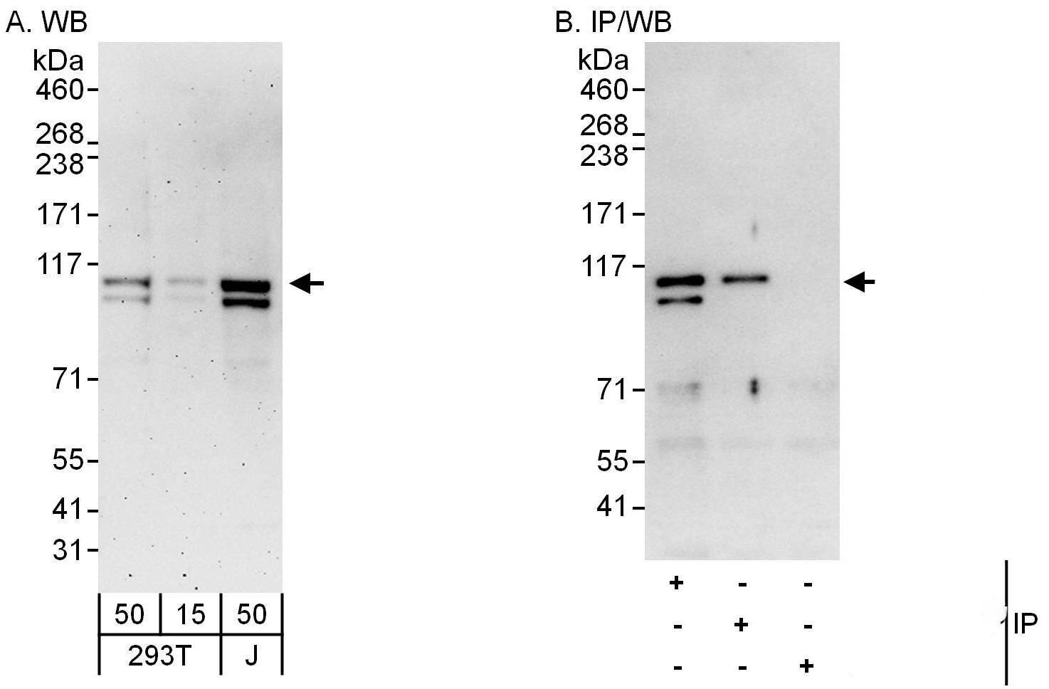 Western Blot:[NBP3-30668]-Detection of human CHD1L by western blot and immunoprecipitation. Samples: Whole cell lysate from HEK293T and Jurkat cells. Antibodies: Affinity purified rabbit anti-CHD1L antibody used for WB at 0. 04 µg/ml and 0. 4 µg/ml and used for IP at 6 µg/mg lysate. CHD1L was also immunoprecipitated by rabbit anti-CHD1L antibody , which recognizes a downstream epitope. Detection: Chemiluminescence with exposure times of 3 minutes and 10 seconds.