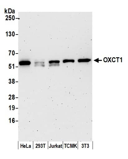 Western Blot:[NBP3-30674]-Detection of human and mouse OXCT1 by western blot. Samples: Whole cell lysate from HeLa, HEK293T, Jurkat, mouse TCMK-1, and mouse NIH 3T3 cells prepared using NETN lysis buffer. Antibody: Affinity purified rabbit anti-OXCT1 antibody used for WB at 0. 04 µg/ml. Detection: Chemiluminescence with an exposure time of 3 minutes.