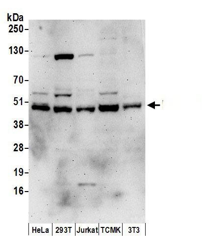 Western Blot:[NBP3-30675]-Detection of human and mouse DNAJA1 by western blot. Samples: Whole cell lysate from HeLa, HEK293T, Jurkat, mouse TCMK-1, and mouse NIH 3T3 cells prepared using NETN lysis buffer. Antibodies: Affinity purified rabbit anti-DNAJA1 antibody used for WB at 0. 1 µg/ml. Detection: Chemiluminescence with an exposure time of 3 minutes.