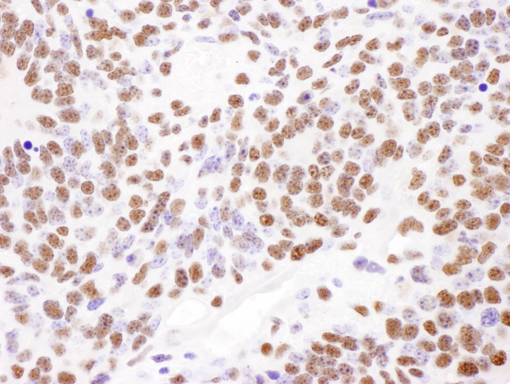 Immunohistochemistry:[NBP3-30680]-Detection of mouse PABPN1 by immunohistochemistry. Sample: FFPE section of mouse teratoma. Antibody: Affinity purified rabbit anti-PABPN1 used at a dilution of 1: 200. Detection: DAB