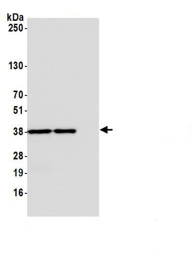 Immunoprecipitation:STING/TMEM173 AntibodyNBP3-30682] -Detection of human STING/TMEM173 by western blot of immunoprecipitates. Samples: Whole cell lysate (1.0 mg per IP reaction; 20% of IP loaded) from Jurkat cells prepared using NETN lysis buffer. Antibodies: Affinity purified rabbit anti-STING/TMEM173 antibody (NBP3-30682 lot 2) used for IP at 0.2 µg per reaction. STING/TMEM173 was also immunoprecipitated by  a different epitope of STING/TMEM173. For blotting immunoprecipitated STING/TMEM173, NBP3-30682 was used at 0.01 mg/ml. Detection: Chemiluminescence with an exposure time of 3 seconds.