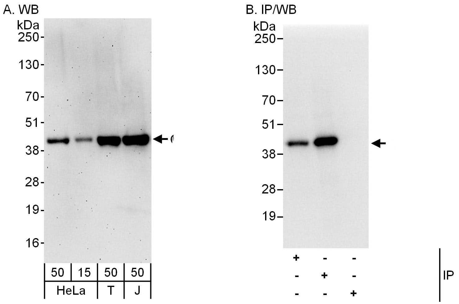 Western Blot:[NBP3-30684]-Detection of human CerS2 by western blot and immunoprecipitation. Samples: Whole cell lysate from HeLa , HEK293T and Jurkat cells. Antibodies: Affinity purified rabbit anti-CerS2 antibody used for WB at 0. 04 µg/ml and 1 µg/ml and used for IP at 6 µg/mg lysate. CerS2 was also immunoprecipitated by rabbit anti-CerS2 antibody , which recognizes an upstream epitope. Detection: Chemiluminescence with exposure times of 3 minutes and 3 seconds.