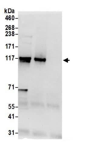 Immunoprecipitation:HIP1 Related AntibodyNBP3-30685] -Detection of human HIP1R/HIP12 by western blot of immunoprecipitates. Samples: Whole cell lysate (0.5 or 1.0 mg per IP reaction; 20% of IP loaded) from 293T cells prepared using NETN lysis buffer. Antibodies: Affinity purified rabbit anti-HIP1R/HIP12 antibody NBP3-30685 (lot NBP3-30685-1) used for IP at 6 µg per reaction. HIP1R/HIP12 was also immunoprecipitated by rabbit anti-HIP1R/HIP12.. For blotting immunoprecipitated HIP1R/HIP12, NBP3-30685 was used at 0.4 µg/ml. Detection: Chemiluminescence with an exposure time of 10 seconds.