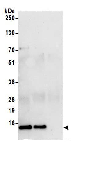 Immunoprecipitation:DYNLT1 AntibodyNBP3-30687] -Detection of human DYNLT1 by western blot of immunoprecipitates. Samples: Whole cell lysate (0.5 or 1.0 mg per IP reaction; 20% of IP loaded) from 293T cells prepared using NETN lysis buffer. Antibody: Affinity purified rabbit anti-DYNLT1 antibody NBP3-30687 (lot NBP3-30687-1) used for IP at 6 µg per reaction. DYNLT1 was also immunoprecipitated by rabbit anti-DYNLT1 antibody BL18782. For blotting immunoprecipitated DYNLT1, NBP3-30687 was used at 0.4 µg/ml. Detection: Chemiluminescence with an exposure time of 10 seconds.