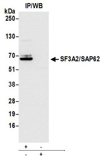 Immunoprecipitation:[NBP3-30688]-Detection of human SF3A2/SAP62 by western blot of immunoprecipitates. Samples: Whole cell lysate from 293T cells prepared using NETN lysis buffer. Antibody: Affinity purified rabbit anti-SF3A2/SAP62 antibody used for IP at 6 µg per reaction. For blotting immunoprecipitated SF3A2/SAP62, was used at 0. 1 µg/ml. Detection: Chemiluminescence with an exposure time of 10 seconds.