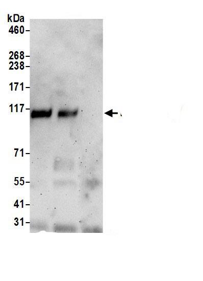 Immunoprecipitation RAI14 Antibody - BSA Free