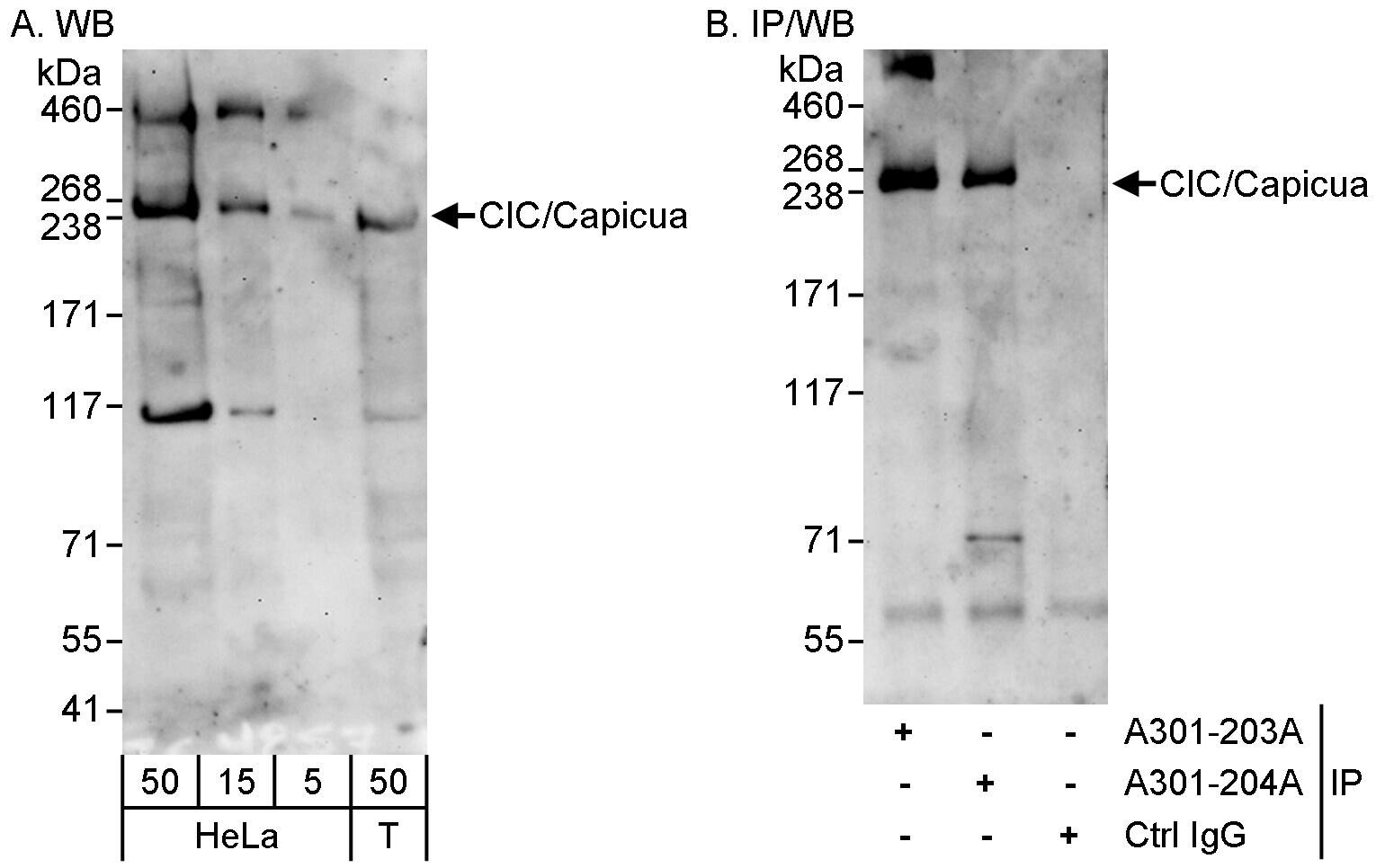 Western Blot:[NBP3-30691]-Detection of human CIC/Capicua by western blot and immunoprecipitation. Samples: Whole cell lysate from HeLa and HEK293T cells. Antibodies: Affinity purified rabbit anti-CIC/Capicua antibody used for WB at 1 µg/ml and used for IP at 3 µg/mg lysate. CIC/Capicua was also immunoprecipitated by rabbit anti-CIC/Capicua antibody , which recognizes an upstream epitope. Detection: Chemiluminescence with exposure times of 3 minutes.