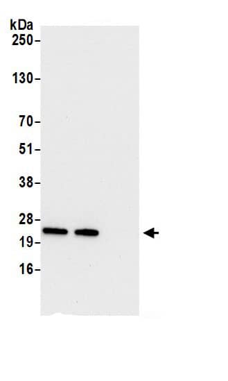 Immunoprecipitation:Biliverdin Reductase B/BLVRB AntibodyNBP3-30692] -Detection of human BLVRB by western blot of immunoprecipitates. Samples: Whole cell lysate (0.5 or 1.0 mg per IP reaction; 20% of IP loaded) from 293T cells prepared using NETN lysis buffer. Antibodies: Affinity purified rabbit anti-BLVRB antibody NBP3-30692 (lot NBP3-30692-1) used for IP at 6 µg per reaction. BLVRB was also immunoprecipitated by rabbit anti-BLVRB.. For blotting immunoprecipitated BLVRB, NBP3-30692 was used at 1 µg/ml. Detection: Chemiluminescence with an exposure time of 10 seconds.