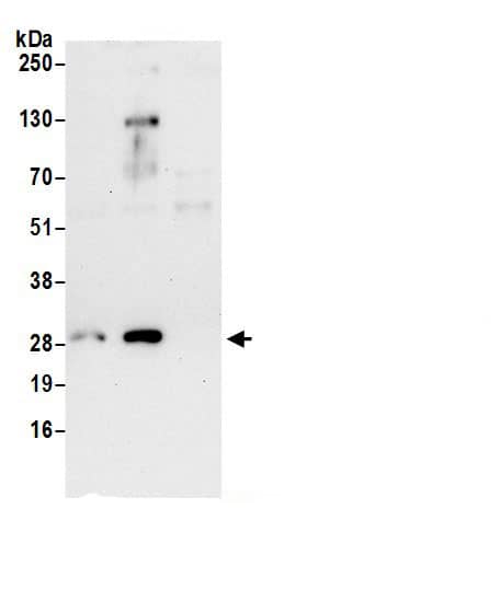 Immunoprecipitation:RPS8 AntibodyNBP3-30693] -Detection of human Ribosomal Protein S8 by western blot of immunoprecipitates. Samples: Whole cell lysate (0.5 or 1.0 mg per IP reaction; 20% of IP loaded) from 293T cells prepared using NETN lysis buffer. Antibodies: Affinity purified rabbit anti-Ribosomal Protein S8 antibody NBP3-30693 (lot NBP3-30693-1) used for IP at 6 µg per reaction. Ribosomal Protein S8 was also immunoprecipitated by rabbit anti-Ribosomal Protein S8 antibody BL19861. For blotting immunoprecipitated Ribosomal Protein S8, NBP3-30693 was used at 1 µg/ml. Detection: Chemiluminescence with an exposure time of 30 seconds.