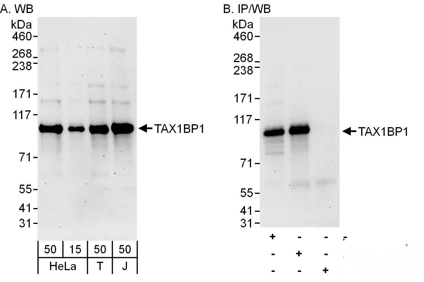 Western Blot:[NBP3-30695]-Detection of human TAX1BP1 by western blot and immunoprecipitation. Samples: Whole cell lysate from HeLa , HEK293T and Jurkat cells. Antibodies: Affinity purified rabbit anti-TAX1BP1 antibody used for WB at 0. 1 µg/ml and 1 µg/ml and used for IP at 6 µg/mg lysate. TAX1BP1 was also immunoprecipitated by rabbit anti-TAX1BP1 antibody , which recognizes a downstream epitope. Detection: Chemiluminescence with exposure times of 3 minutes and 30 seconds.