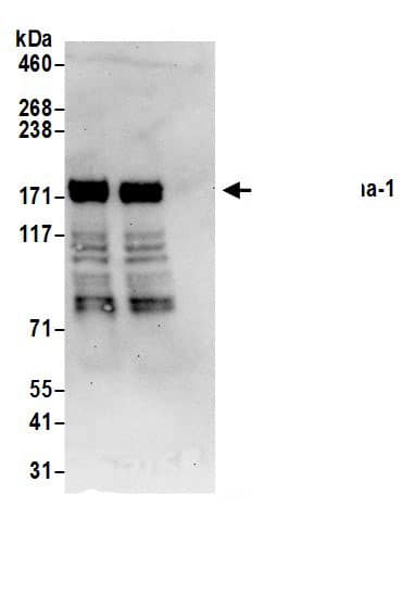 Immunoprecipitation:Liprin alpha 1 AntibodyNBP3-30696] -Detection of human Liprin-alpha-1 by western blot of immunoprecipitates. Samples: Whole cell lysate (0.5 or 1.0 mg per IP reaction; 20% of IP loaded) from 293T cells prepared using NETN lysis buffer. Antibodies: Affinity purified rabbit anti-Liprin-alpha-1 antibody NBP3-30696 (lot NBP3-30696-1) used for IP at 6 µg per reaction. Liprin-alpha-1 was also immunoprecipitated by rabbit anti-Liprin-alpha-1 antibody BL17157. For blotting immunoprecipitated Liprin-alpha-1, NBP3-30696 was used at 1 µg/ml. Detection: Chemiluminescence with an exposure time of 30 seconds.