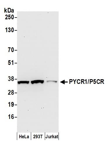 Western Blot:[NBP3-30697]-Detection of human PYCR1/P5CR by western blot. Samples: Whole cell lysate from HeLa, HEK293T, and Jurkat cells prepared using NETN lysis buffer. Antibody: Affinity purified rabbit anti-PYCR1/P5CR antibody used for WB at 0. 1 µg/ml. Detection: Chemiluminescence with an exposure time of 30 seconds.