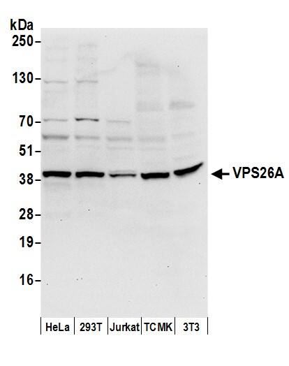 Western Blot:[NBP3-30699]-Detection of human and mouse VPS26A by western blot. Samples: Whole cell lysate from HeLa, HEK293T, Jurkat, mouse TCMK-1, and mouse NIH 3T3 cells prepared using NETN lysis buffer. Antibody: Affinity purified rabbit antibody used for WB at 0. 4 µg/ml. Detection: Chemiluminescence with an exposure time of 10 seconds.