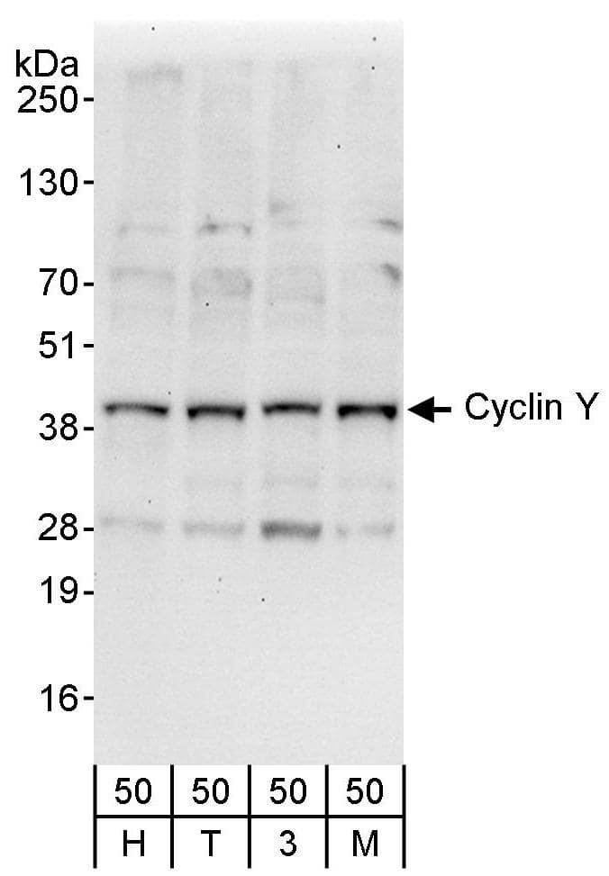 Western Blot:[NBP3-30700]-Detection of human Cyclin Y by western blot. Samples: Whole cell lysate from HeLa , HEK293T , mouse NIH 3T3 , and MCF-7 cells. Antibodies: Affinity purified rabbit anti-Cyclin Y antibody used for WB at 1 µg/ml. Detection: Chemiluminescence with an exposure time of 30 seconds.