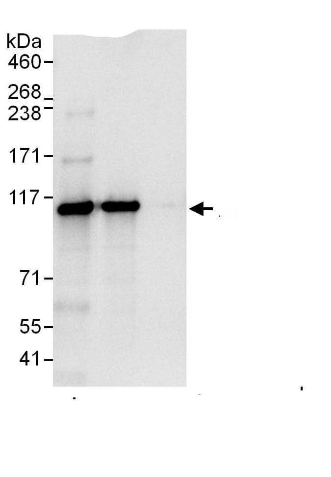 Immunoprecipitation:Rpn2 AntibodyNBP3-30706] -Detection of human PSMD1 by western blot of immunoprecipitates. Samples: Whole cell lysate (1 mg for IP; 20% of IP loaded) from HEK293T cells. Antibodies: Affinity purified rabbit anti-PSMD1 antibody NBP3-30706 (lot NBP3-30706-1) used for IP at 6 µg/mg lysate. PSMD1 was also immunoprecipitated by rabbit anti-PSMD1.. For blotting immunoprecipitated PSMD1, NBP3-30706 was used at 1 µg/ml. Detection: Chemiluminescence with an exposure time of 3 seconds.