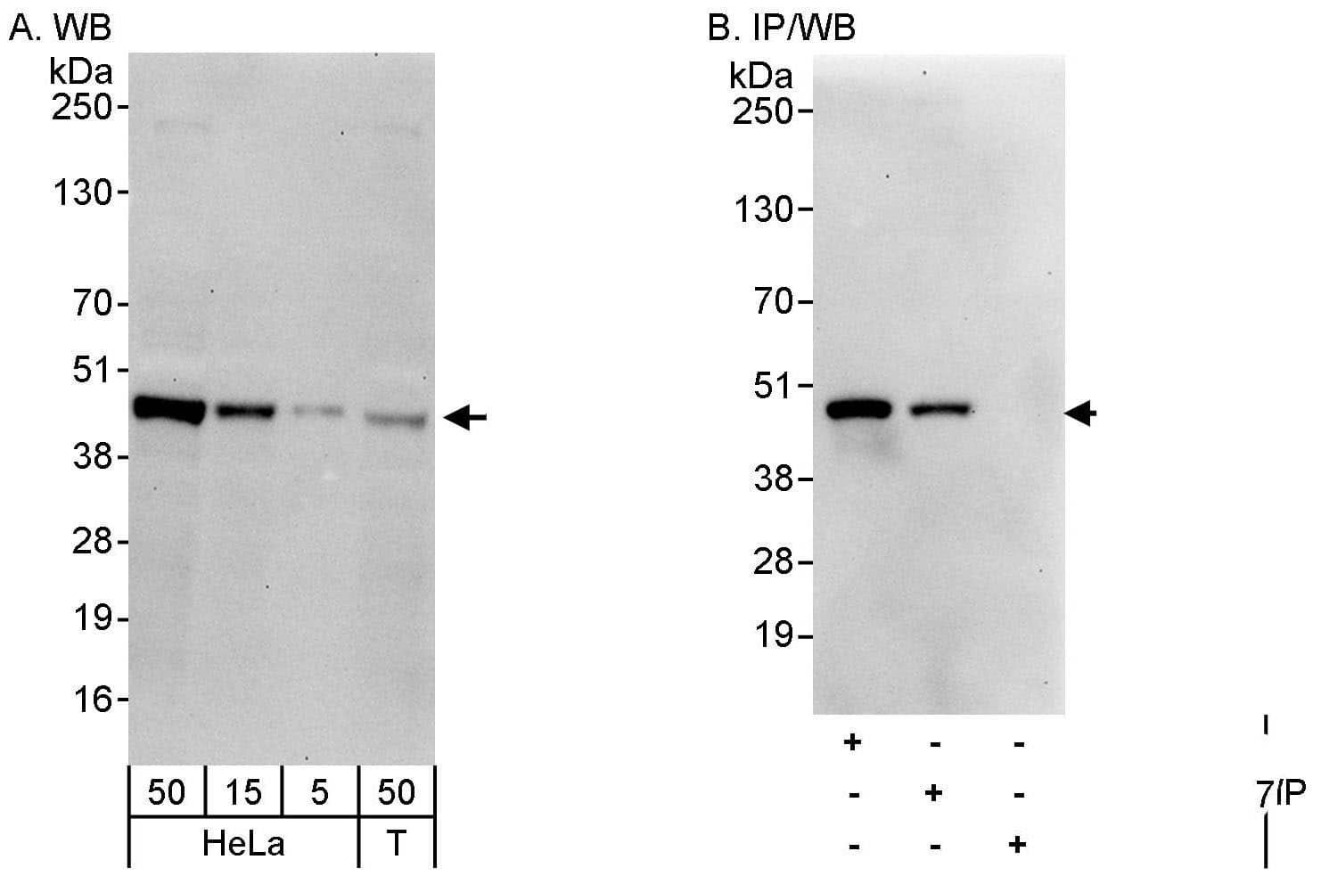 Western Blot:[NBP3-30707]-Detection of human CaMKI delta by western blot and immunoprecipitation. Samples: Whole cell lysate from HeLa and HEK293T cells. Antibodies: Affinity purified rabbit anti-CaMKI delta antibody used for WB at 0. 1 µg/ml and 1 µg/ml and used for IP at 3 µg/mg lysate. CaMKI delta was also immunoprecipitated by rabbit anti-CaMKI delta antibody , which recognizes an upstream epitope. Detection: Chemiluminescence with exposure times of 30 seconds.