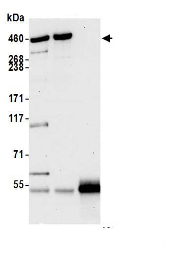 Immunoprecipitation:BRCA2 AntibodyNBP3-30709] -Detection of human BRCA2 by western blot of immunoprecipitates. Samples: Whole cell lysate (1.0 mg per IP reaction; 20% of IP loaded) from HEK293T cells prepared using NETN lysis buffer. Antibodies: Rabbit anti-BRCA2 antibody NBP3-30709 (lot NBP3-30709-4) used for IP at 6 µg per reaction. BRCA2 was also immunoprecipitated by a previous lot of this antibody (lot NBP3-30709-3). For blotting immunoprecipitated BRCA2, NBP3-30709 was used at 0.1 µg/ml. Detection: Chemiluminescence with an exposure time of 30 seconds.