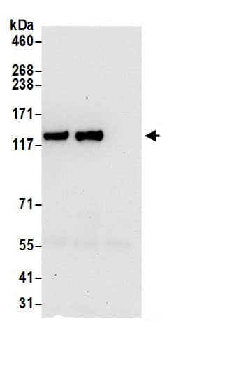 Immunoprecipitation:ZFR AntibodyNBP3-30710] -Detection of human ZFR by western blot of immunoprecipitates. Samples: Whole cell lysate (0.5 or 1.0 mg per IP reaction; 20% of IP loaded) from 293T cells prepared using NETN lysis buffer. Antibody: Affinity purified rabbit anti-ZFR antibody NBP3-30710 (lot NBP3-30710-1) used for IP at 6 µg per reaction. ZFR was also immunoprecipitated by rabbit anti-ZFR antibody. For blotting immunoprecipitated ZFR, NBP3-30710 was used at 1 µg/ml. Detection: Chemiluminescence with an exposure time of 30 seconds.