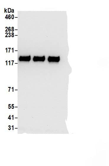 Immunoprecipitation:SEC24B AntibodyNBP3-30711] -Detection of human SEC24B by western blot of immunoprecipitates. Samples: Whole cell lysate (0.5 or 1.0 mg per IP reaction; 20% of IP loaded) from 293T cells prepared using NETN lysis buffer. Antibodies: Affinity purified rabbit anti-SEC24B antibody NBP3-30711 (lot NBP3-30711-1) used for IP at 6 µg per reaction. SEC24B was also immunoprecipitated by rabbit anti-SEC24B antibodies A304-877A and A304-878A. For blotting immunoprecipitated SEC24B, NBP3-30711 was used at 0.4 µg/ml. Detection: Chemiluminescence with an exposure time of 10 seconds.